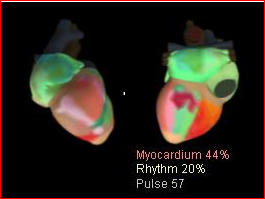 cardiovisor web_html_244a6aba