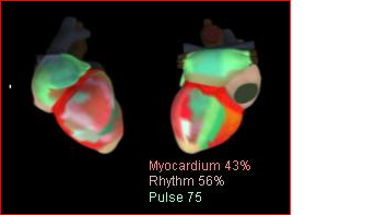 cardiovisor web_html_4fa86c7b