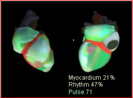 cardiovisor web_html_m11112d06