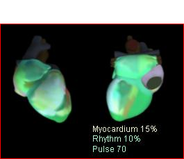 cardiovisor web_html_m45e17099