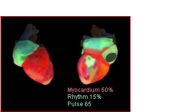 cardiovisor web_html_m6adf561