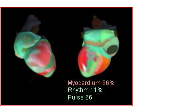 cardiovisor web_html_m76248614